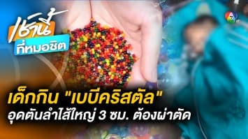 เตือนภัย ! เด็ก 1 ขวบ กิน “เบบีคริสตัล” อุดตันลำไส้ ต้องผ่าตัดด่วน