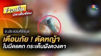 หมอโพสต์เตือน ! ตัดหญ้าไม่สวมแว่นป้องกัน ระวังใบมีดแตก กระเด็นฝังดวงตา 