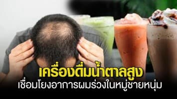 งานวิจัยชี้ เครื่องดื่มน้ำตาลสูง เชื่อมโยงอาการผมร่วงในหมู่ชายหนุ่ม