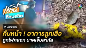 คืบหน้า ! ไฟคลอก “ลูกเสือ” กลางค่าย ไหม้ร่างกาย 90 อาการสาหัส