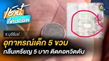 อุทาหรณ์ ! ลูกอายุ 5 ขวบ อมเหรียญ 5 บาท ติดหลอดอาหาร จ.บุรีรัมย์