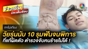 เมียร้อง ! ผัวถูกวัยรุ่นนับ 10 รุมฟันจนพิการ ที่แท้ผิดตัว ตำรวจจับคนร้ายไม่ได้ | ถกไม่เถียง