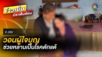 ยายวอนผู้ใจบุญ ช่วยหลานวัย 10 ขวบ ป่วย “โรคดักแด้” สุดทรมาน จ.เลย