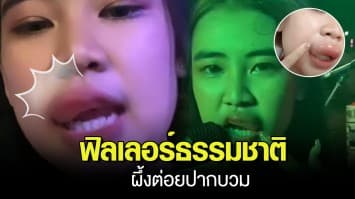 ทั้งขำ ทั้งสงสาร นักร้องสาวสู้ชีวิต ถูกผึ้งต่อยปากบนเวที โอด คนในงานเป็นร้อย แต่ต่อยฉันแค่คนเดียว