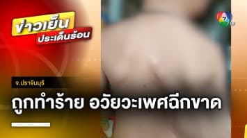 สะเทือนใจ ! ครูจับสังเกตุ พบเด็กชายถูกทำร้าย อวัยวะเพศฉีกขาด จ.ปราจีนบุรี