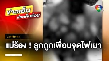 แม่ร้อง ! ลูกถูกเพื่อนราดแอลกอฮอล์ จุดไฟเผา แม่คู่กรณีขอเยียวยาแค่ 2 พัน จ.ฉะเชิงเทรา