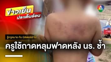 เปิดกฎหมาย ! เด็ก 2 ขวบ ถูกครูใช้ถาดหลุมฟาดช้ำทั้งหลัง จ.ร้อยเอ็ด | รู้กฎหมาย กับ มิสเตอร์ฆ่าโง่