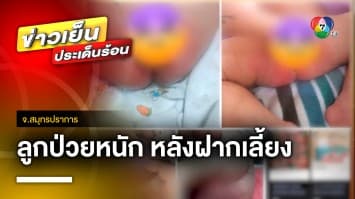 แม่โพสต์เตือน ! ฝากเลี้ยงลูกได้ 2 วัน ป่วยหนัก จ.สมุทรปราการ | ข่าวเย็นประเด็นร้อน