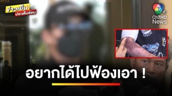 เปิดกฎหมาย ! ปมเด็ก 14 ปี ถูกไฟคลอกขณะทำกิจกรรมในห้องเรียน | รู้กฎหมาย กับ มิสเตอร์ฆ่าโง่