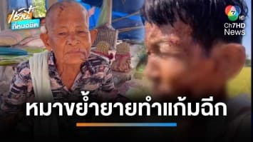 เลี้ยงไม่เชื่อง ! หมาขย้ำยายวัย 77 ปี เลือดท่วม แก้มฉีกเย็บ 40 เข็ม | เช้านี้ที่หมอชิต