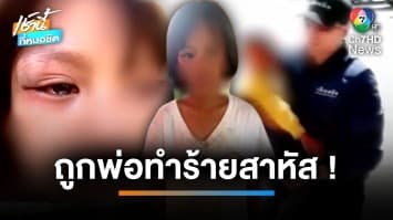 ช่วยเด็ก 8 ขวบ ถูกพ่อใช้ไม้ไผ่ตีสาหัส พ่อยอมรับทำจริงเพราะโมโห | เช้านี้ที่หมอชิต