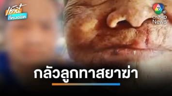 เศร้า ! แม่ป่วยติดเตียงวอนช่วย ถูกลูกคลั่งยาทำร้าย หวั่นถูกลูกฆ่า | เช้านี้ที่หมอชิต