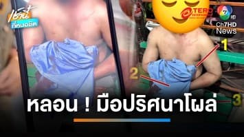 กู้ภัยหลอน ! เจอ “มือปริศนา” โผล่หน้าตักคนเจ็บ | เช้านี้ที่หมอชิต