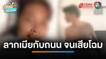 สาวร้อง ! ถูกแฟนหนุ่มซ้อม - ขับรถลากหัวกระแทกถนนสาหัส | เช้านี้ที่หมอชิต