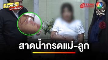 “กัน จอมพลัง” พาแม่-ลูก ขอความเป็นธรรม เหตุถูกสาดน้ำกรดเจ็บสาหัส | ข่าวเย็นประเด็นร้อน