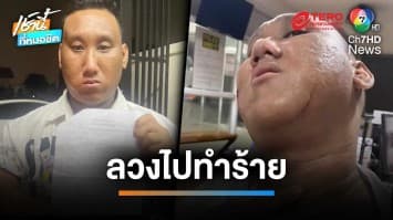 “แบงค์ เลสเตอร์” ดาวติ๊กต๊อก ถูกอริลวงทำร้าย มีดจี้คอ-ขอเตะยอดหน้า | เช้านี้ที่หมอชิต 