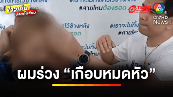 สาวช็อก ! ใช้ครีมย้อมผมยี่ห้อดัง ผมร่วง “เกือบหมดหัว” แบรนด์แนะให้ “โกนทิ้ง” | ถกไม่เถียง