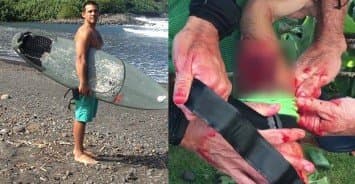 หนุ่มนักเซิร์ฟเผยนาทีเฉียดตาย หลังเปิดฉากต่อสู้ฉลามร้ายกลางทะเลที่ฮาวาย