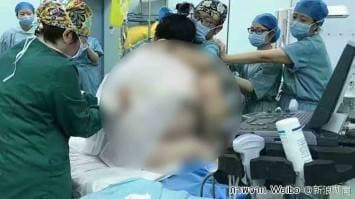 แพทย์จีน 16 คน ร่วมมือผ่าคลอดหญิงหนัก 127 กก. เสี่ยงสูงจากภาวะครรภ์เป็นพิษ-โรครุมเร้า