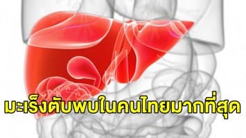 กรมการแพทย์เผย มะเร็งตับพบมากเป็นอันดับ 1 ในไทย แนะปรับพฤติกรรมด้านการกินลดความเสี่ยง